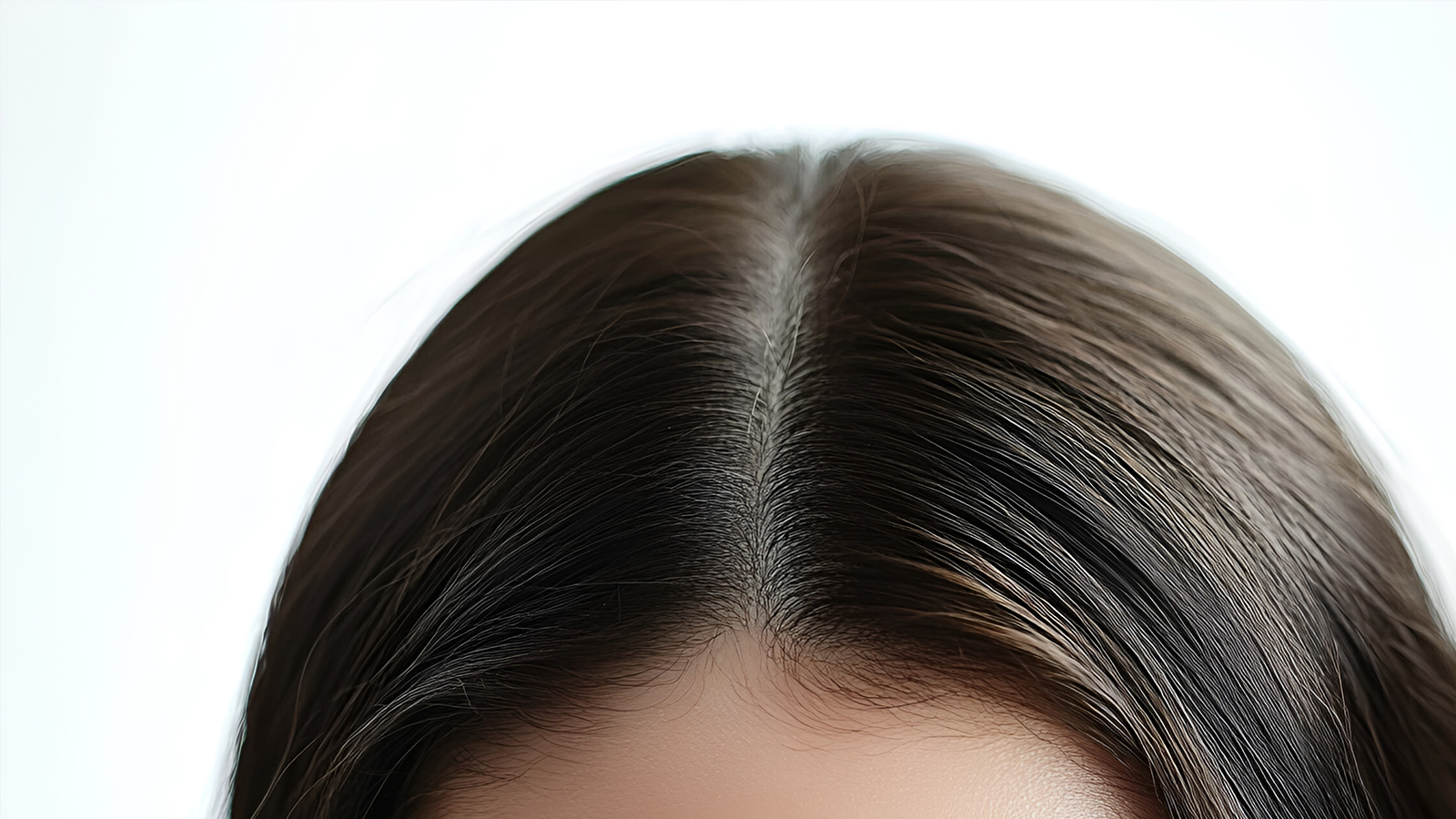 Treating Wide Hair Parting