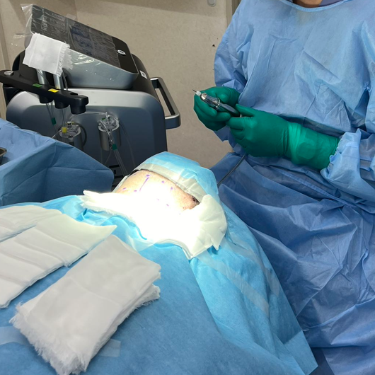 Technological Breakthroughs in Hair Transplant Devices